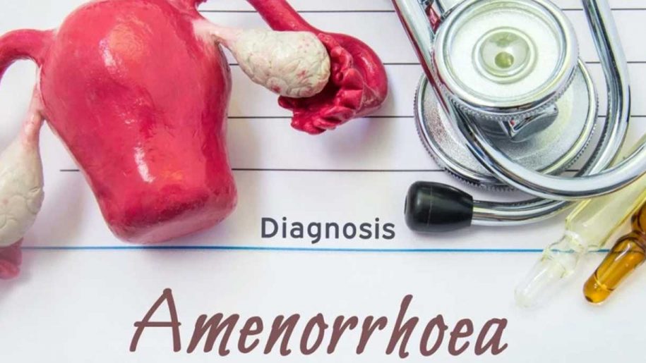 Amenorrhea from an Ayurveda Perspective